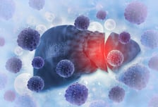 혈관 맞닿은 간암 세포, 3천 볼트 전기로 지져 없애…국내 첫 사례