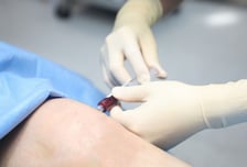 무릎 관절염 끝판왕? 사실은…'줄기세포 주사' 허와 실