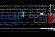 "사람 판독 결과와 80% 이상 일치"…수면 단계 나누는 AI, 한국서 개발
