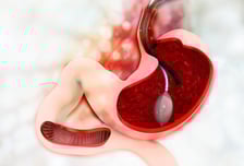 "양성입니다" 코로나 때 기억에 철렁…위내시경 후 놀라지 마세요