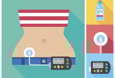 2형 당뇨병 환자, 인슐린펌프에 '이것' 추가했더니 인슐린 사용량 더 줄어