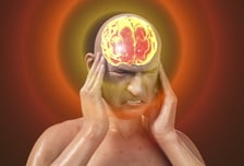 "뇌경색 환자 63%는 골든타임 놓쳐"…10년 동안 달라진 게 없었다