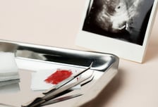 초음파 68회에도 암 못 찾은 한의사 '무죄'…양·한방, 날 세운 이유