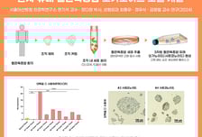 '두피 희귀암'서 뗀 조직, 세계 첫 배양 성공…맞춤 항암 시대 열릴까
