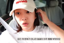 얼굴 퉁퉁 부은 손담비 "난자 많지 않아"…시험관 시술 고충