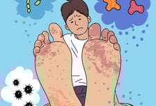 긁기도 민망한 '사타구니' 가려움…발 무좀 때문이라고?[한 장으로 보는 건강]