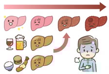 술도 안 마시는데 찾아온 지방간…○○○암 위험 '4.7배'