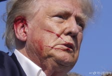 주먹 불끈 쥔 트럼프, 청력 잃을 수도…의사의 경고