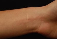 "성적 부담감이 너무 컸어요" 요즘 자해 청소년, 흉터 가리려 '이것'까지