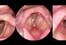 술 마시며 담배 한 모금 '뽁'… 머리·목에 장애 유발하는 '이 암'