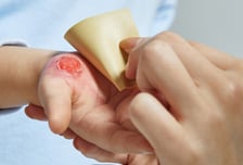 미국처럼 응급실 진료비 폭탄?…"의식 있다면 경증" 발표에 의사들 반박