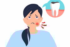 사랑니, 아프지 않아도 '이럴 땐' 빼야