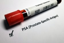 "일본처럼 '남성암' 1위 머잖았다…중년부터는 매년 '이 검사' 받아야"