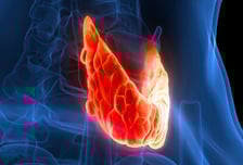 '착한' 암은 없다…"과잉진단" 논란 그 후, 갑상선암 사망률 다시 증가