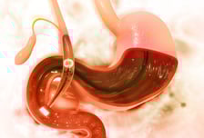 담도에 내시경 검사, 무엇이 좋나? 국내 연구진 세계 첫 '비교 연구' 발표