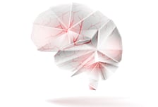 "치매 원인" 나이따라 달라…65세 이상, 뇌 독성물질보다 '이것' 더 중요