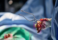 '아시아 최초'로 성공하더니 또 일냈다…80대 환자 살린 '최고난도 시술'