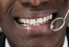 어쩐지 음식물 잘 끼더라…난데없는 '삼각형 구멍'이 보낸 신호[한 장으로 보는 건강]