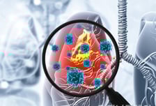 폐암보다 무섭다…"기침·열도 없는데 폐렴" 노인에 치명적