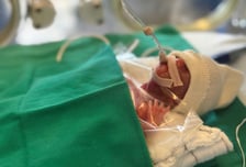 한국서 제일 작은 아기, 엄마 품으로…260g→3.19kg '기적의 퇴원'