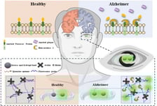 눈에 넣으면 치매인지 알려준다? 인공수정체 형광 센서, 한국서 개발