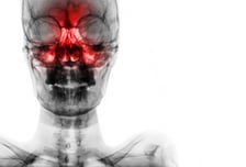 "약발 안 듣는" 알레르기 비염, '코 수술' 효과 몇 년 가나 봤더니