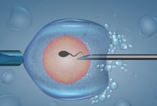 무정자증 남편, 이 시술 했더니 '아빠' 됐다…5년새 12배 '급증'