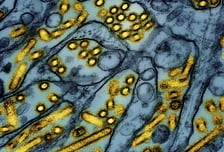 "잘 알려지지 않은 바이러스" 중국서 또 감염병이…미국도 심상찮다