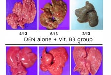 "간에서 암세포 싹 사라져" 비타민B3 권위자, 환호한 이유