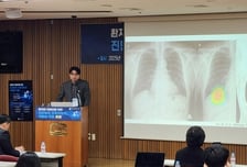 "폐렴입니다" AI가 진단?..."영상의학전문의 대신하는건 시기상조"