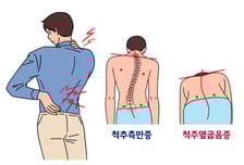 "5㎝ 더 커질 수 있어요"…겨울 방학 숨은 키 찾는 법