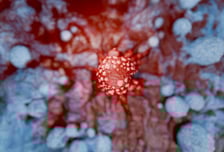 "밖에서 운동했을 뿐인데" 피부암 충격…1급 발암물질 '이것' 때문