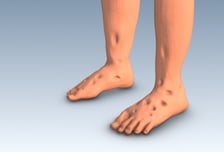 "베개 몇 개 더" 부모님 이 말, 심장이 보내는 SOS?…사망 부르는 이 병