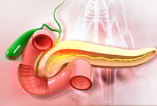 발견해도 80% '수술 불가'…간암서 성과 낸 치료법, 췌장암에도 효과?