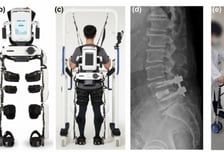 재활로봇 큰 효과 "일상생활 능력 39% 향상…낙상 공포 없어 만족"