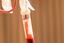 전공의 떠난 직후 수혈 2만2000건 뚝…상급종합병원 환자 피해 더 컸다