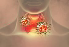 "지켜봅시다" 미세 갑상선암 불안했는데…"바늘 하나로 96% 없앴다"