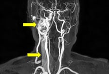 "귀에서 이런 소리가 들려"…심혈관·자궁 빨간불 신호?