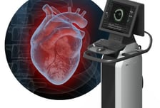 심혈관 의료기기 업체 레이와트, 85억 원 시리즈A 투자 유치