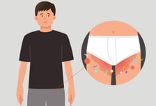 무좀 있는 사람이 '팬티' 그냥 입는다고?…큰일날 습관[한 장으로 보는 건강]