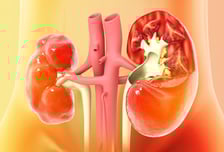 "자다가 화장실 들락날락" 야간뇨 반복, 왜?…'이 병'이었다