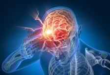 "뇌진탕 1년 지났는데 이럴 수가"…'이 병' 위험 2배 이상 높았다