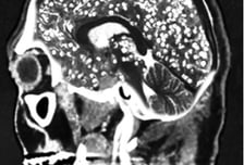 사람 조종하는 기생충…'기생충 다이어트'도 있을까?[한 장으로 보는 건강]