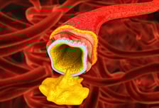 콜레스테롤 부족하면 머리 나빠진다? 천만에…"치매 위험 28% 줄어"