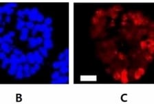 두경부암 발생 이끈 돌연변이 유전자, 한국 의료진이 찾았다