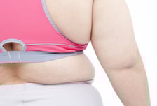 유방암 환자, 체중 10% 늘면 뇌졸중 83%·심부전 85% 위험 증가