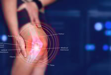 "무릎뼈 어긋날 조짐 보여요" 이런 경종 울리는 AI, 한국서 나왔다