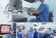 H+양지병원, 로봇수술로 정상보다 12배 더 큰 '거대 전립선' 제거 성공