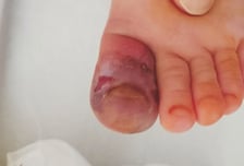 "귀여워" 뽀뽀했다가 아이 눈 실명…"흔하지만 위험" 이 바이러스 정체