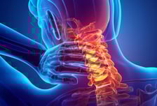 "설마 뇌졸중?" 젓가락질 못하는 부모님 걱정했는데…문제 따로 있었다